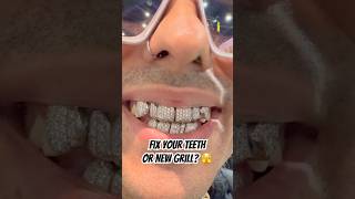 Fix your teeth or get a grill 😱 johnnydang grillz teeth diamond jewelry dentist shorts [upl. by Jorge231]