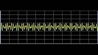 Q Fever Coxiella burnetiiRickettsia  Rife Frequencies [upl. by Ytineres453]