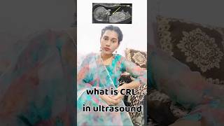 what is CRL in pregnancy ultrasound reportsnehamomlifestyle [upl. by Faso706]