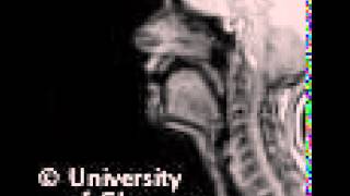 MRI voiced alveolar trill [upl. by Danyluk]