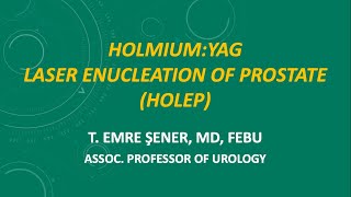 Enbloc HoLEP with Early Apical Release using a Low Power Laser [upl. by Marinna]