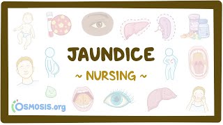 Jaundice Clinical Nursing Care [upl. by Retswerb986]