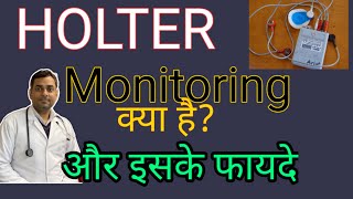 Holter monitoring की पूरी जानकारी हिंदी में [upl. by Maddock]