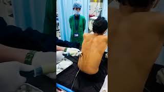 Pleural tappingThoracocentesis viralvideo viralreels youtube youtuber tranding youtubeshort [upl. by Notniw]