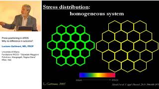 Prone position in ARDS L Gattinoni 2005 Strasburg 23 [upl. by Nyhagen]