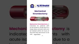 Mechanical Thrombectomy [upl. by Ecirehc188]