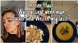 Ernährungsumstellung inkl Rezepte  Hautprobleme Spätakne Die Siwuchins [upl. by Valli319]