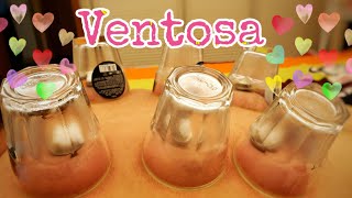 How to Ventosa at Home  Cupping Therapy  Ventosa Procedure [upl. by Monetta]