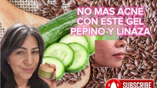 Gel de linaza y pepino para combatir el acne los resultados son increhiblesquot [upl. by Hadnama]