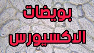 يرقة الاكسيورس تتحرك داخل البويضة [upl. by Harihs354]