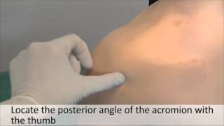 Musculoskeletal Examination and Joint Injection Series Shoulder Joint AspirationPosterior [upl. by Norrv]