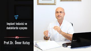 İmplant Tedavisi Ve Dudaklarda Uyuşma [upl. by Concordia]