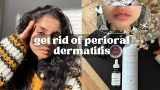 my perioral dermatitis journey  what actually worked what didnt natural healing and more [upl. by Snej]