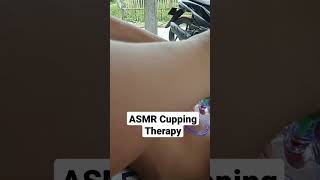 ASMR Cupping Therapy asmr viral cupping [upl. by Betti]