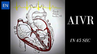 Accelerated Idioventricular Rhythm Animation and ECG Shorts [upl. by Grinnell185]