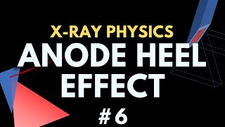 Anode Heel Effect  Xray physics 6  Radiology Physics Course 13 [upl. by Forsyth298]