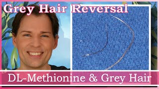 GREY HAIR REVERSAL CATALASE HELP AND DLMETHIONINE  HYDROGEN PEROXIDE  ANTIOXIDANTS  STOP GREYS [upl. by Enyar]