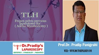 TLHFrozen Pelvis Previous Laparotomy forAdeno Myomectomylaparoscopicsurgeon video doctor [upl. by Aldwon483]