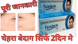 Hydroquinone Tretinoin amp Mometasone Furoate Cream Review by Guru Kirpa Clinic [upl. by Alikat]