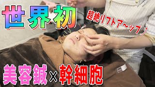 【幹細胞】美容鍼×幹細胞、世界初の技術！アラフォー男性の肌が超絶リフトアップ！【togohariking 】 [upl. by Cob]