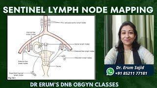 Sentinel Lymph node mapping  DNB Theory Class  DNB OBGYN coaching All India chapter Dr Erum Sajid [upl. by Ettezoj]