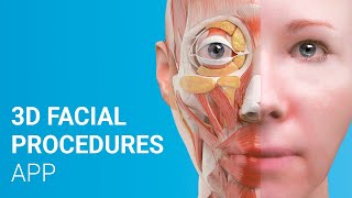 3D Facial Procedures App Surgical amp Non−Surgical Procedures [upl. by Ariamat]