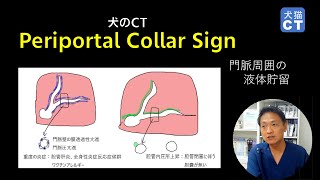 Periportal collar sign（7分50秒） [upl. by Nirret]