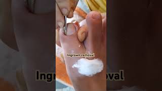 satisfying and relaxing pedicure pedicure relaxing satisfying nailcare [upl. by Anais435]