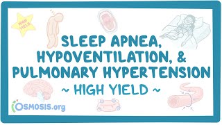 Apnea hypoventilation and pulmonary hypertension Pathology review [upl. by Llertnom743]