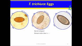 Trichuris trichiura Nematodes [upl. by Mclaurin]