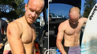 ‘I just punched it in the face’ Surfer describes fending off shark [upl. by Thorbert]