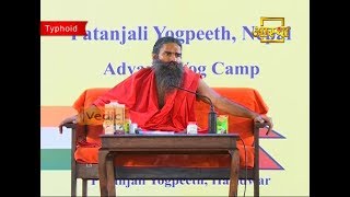 How to Cure Typhoid Fever Permanently with Natural Remedies  Swami Ramdev [upl. by Leugimsiul]