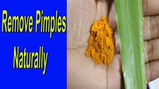 How To Remove Pimples beauty tips in Telugu  Aloe vera Turmeric to Get Rid Of Pimples beauty hacks [upl. by Odracer725]