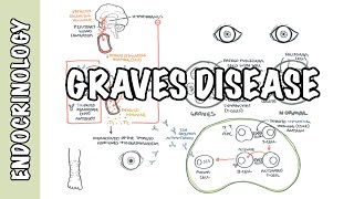 Graves Disease  Overview causes pathophysiology investigations and treatment [upl. by Ultann]