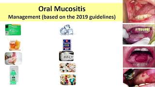 5 Oral Mucositis [upl. by Canada]