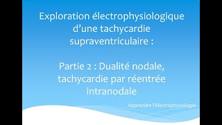 Exploration électrophysiologique dune TSV Partie 2  Dualité nodale et TRIN [upl. by Artaed]