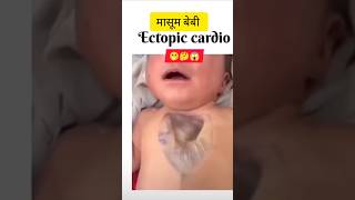 Ectopic cadiacectopicdoctorlifecryingbabyrahatfatehalikhan [upl. by Evaleen]