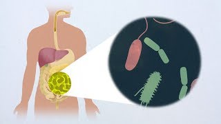 Antagonism toward the intestinal microbiota and its effect on Vibrio cholerae virulence [upl. by Enneillij]