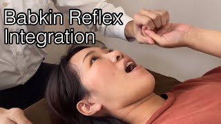 Reflex treatment for Babkin reflex [upl. by Mayor]