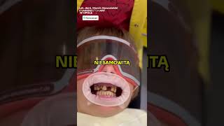 😍NIESAMOWITY DENTYSTA🦷😱 [upl. by Tnayrb]