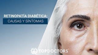 Retinopatía Diabética causas y síntomas [upl. by Tsenrae]