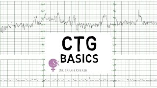 CTG Basics [upl. by Frissell]