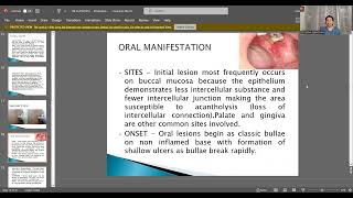 VESICULOBULLOUS LESIONS OF ORAL CAVITY BY Dr JEENA SEBASTIAN  DEPT OF ORAL MEDICINE AND RADIOLOGY [upl. by Demp]