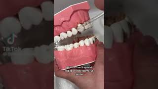 IRRIGADOR DENTAL [upl. by Hafeetal]