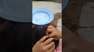 lice Removal part 12shots [upl. by Arihsa]