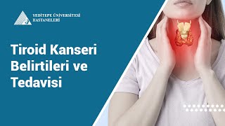 Tiroid Kanseri Belirtileri ve Tedavisi  Prof Dr Erhan Ayşan [upl. by Ron770]