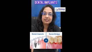 Dental Implants  Dental implants vs dental bridges [upl. by Aprile]