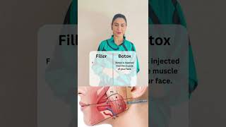 Botox Vs Filler [upl. by Nara]