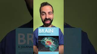 BRAIN ON HEAD IN BRAIN [upl. by Hodges]