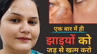 कितनी भी पुरानी झाइयांPigmentation जड़ से खत्म करो  How to Remove Pigmentation 100 Results [upl. by Yht]